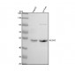 Anti-ALDH2 Monoclonal Antibody